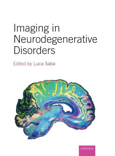 Cover image for Imaging in Neurodegenerative Disorders