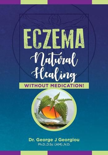 Eczema: Natural Healing, Without Medication