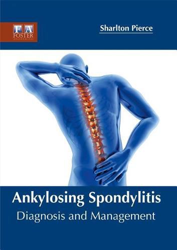 Cover image for Ankylosing Spondylitis: Diagnosis and Management