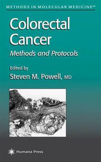 Cover image for Colorectal Cancer: Methods and Protocols