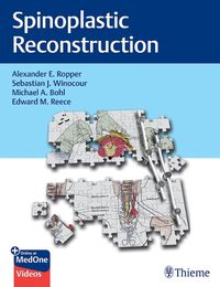 Cover image for Spinoplastic Reconstruction