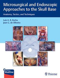 Cover image for Microsurgical and Endoscopic Approaches to the Skull Base: Anatomy, Tactics, and Techniques