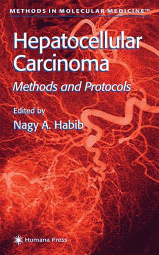 Cover image for Hepatocellular Carcinoma: Methods and Protocols