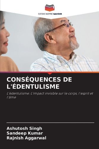 Cover image for Consequences de l'Edentulisme