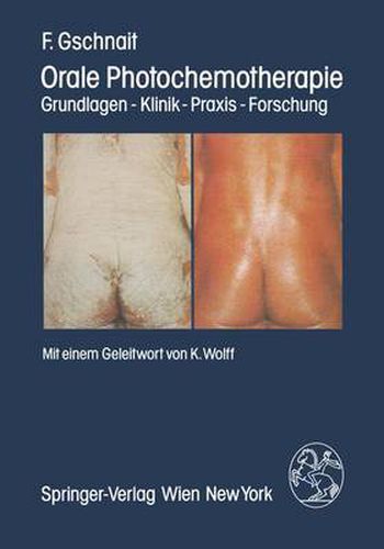 Cover image for Orale Photochemotherapie: Grundlagen -- Klinik -- Praxis -- Forschung