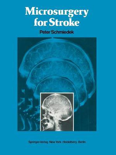 Cover image for Microsurgery for Stroke