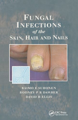 Cover image for Fungal Infections of the Skin and Nails