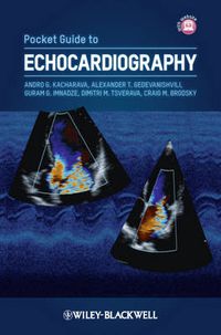 Cover image for Pocket Guide to Echocardiography