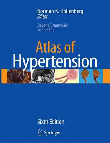 Cover image for Atlas of Hypertension