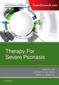 Cover image for Therapy for Severe Psoriasis
