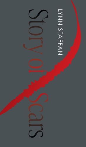 Cover image for Story of Scars