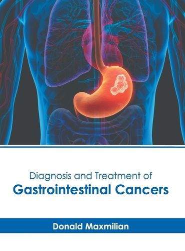 Cover image for Diagnosis and Treatment of Gastrointestinal Cancers