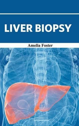 Cover image for Liver Biopsy