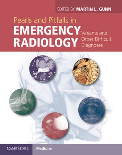 Cover image for Pearls and Pitfalls in Emergency Radiology: Variants and Other Difficult Diagnoses