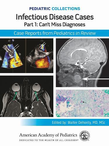 Cover image for Infectious Disease Cases: Part 1: Can't Miss Diagnoses