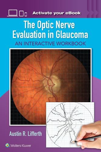 Cover image for The Optic Nerve Evaluation in Glaucoma: An Interactive Workbook