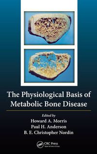 Cover image for The Physiological Basis of Metabolic Bone Disease