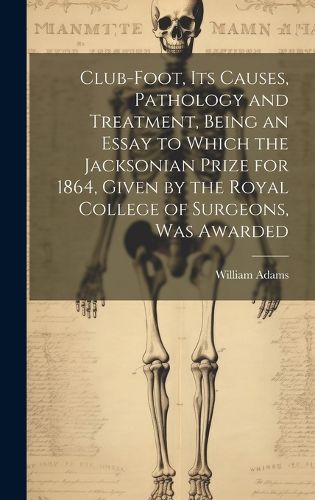 Cover image for Club-foot, its Causes, Pathology and Treatment, Being an Essay to Which the Jacksonian Prize for 1864, Given by the Royal College of Surgeons, was Awarded