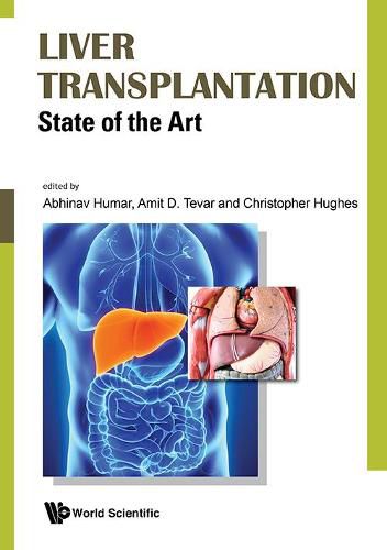 Cover image for Liver Transplantation: State Of The Art