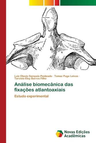 Analise biomecanica das fixacoes atlantoaxiais