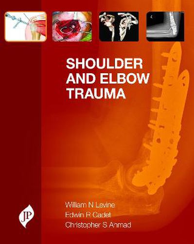 Cover image for Shoulder and Elbow Trauma