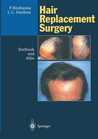 Cover image for Hair Replacement Surgery: Textbook and Atlas