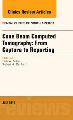 Cover image for Cone Beam Computed Tomography: From Capture to Reporting, An Issue of Dental Clinics of North America