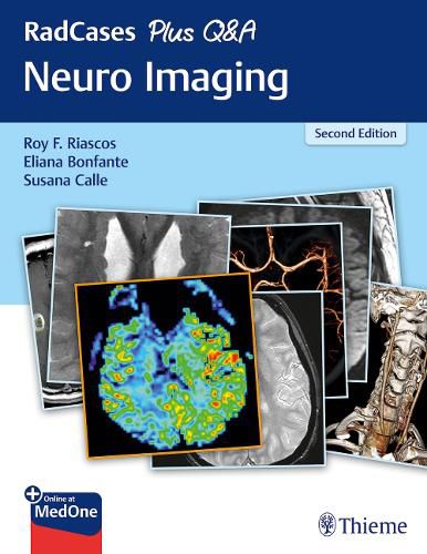 Cover image for RadCases Plus Q&A Neuro Imaging