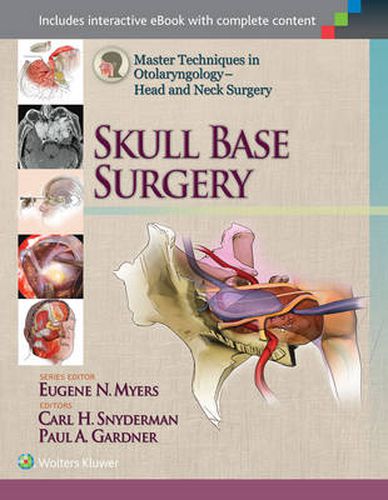 Cover image for Master Techniques in Otolaryngology - Head and Neck Surgery: Skull Base Surgery
