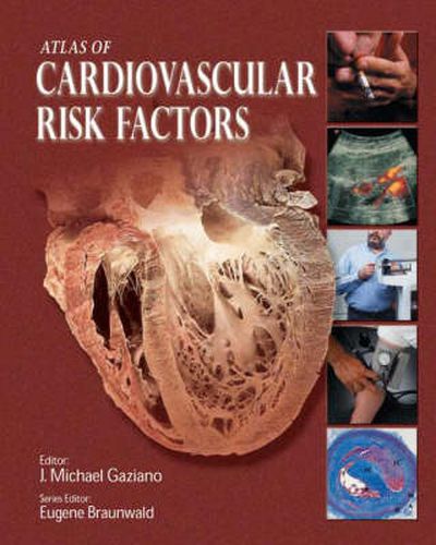Cover image for Atlas of Cardiovascular Risk Factors