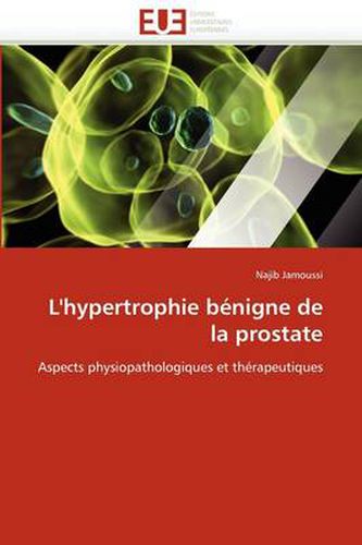 Cover image for L'Hypertrophie B Nigne de La Prostate