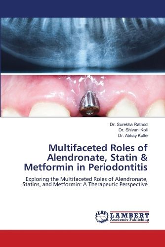 Cover image for Multifaceted Roles of Alendronate, Statin & Metformin in Periodontitis