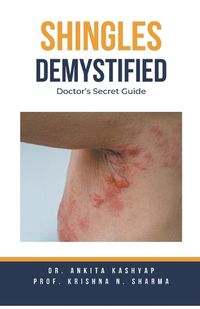 Cover image for Shingles Demystified