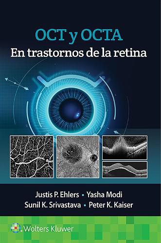 Cover image for OCT y OCTA en trastornos de la retina