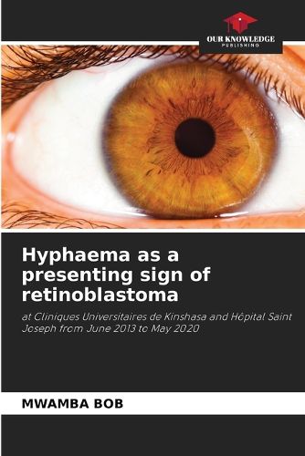 Cover image for Hyphaema as a presenting sign of retinoblastoma