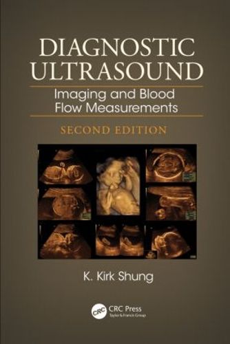 Cover image for Diagnostic Ultrasound: Imaging and Blood Flow Measurements, Second Edition