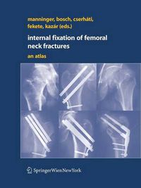 Cover image for Internal fixation of femoral neck fractures: An Atlas