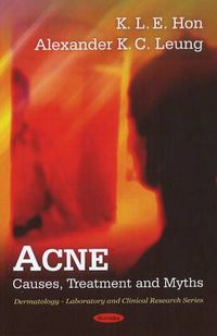 Cover image for Acne: Causes, Treatment & Myths