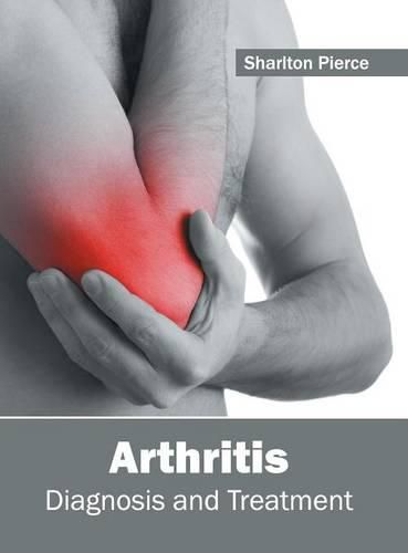 Cover image for Arthritis: Diagnosis and Treatment