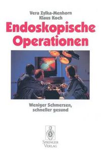 Cover image for Endoskopische Operationen