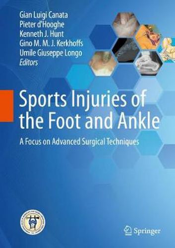 Cover image for Sports Injuries of the Foot and Ankle: A Focus on Advanced Surgical Techniques