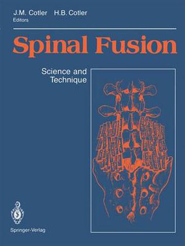 Cover image for Spinal Fusion: Science and Technique