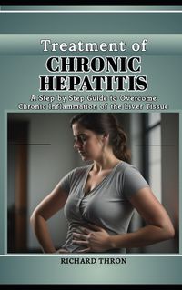 Cover image for Treatment of Chronic Hepatitis