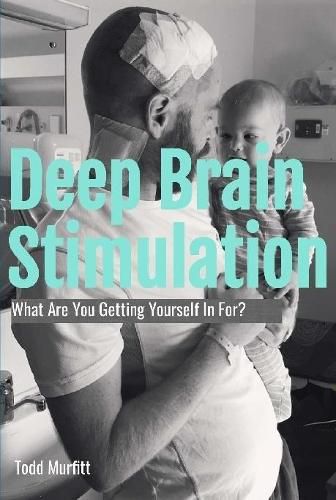 Cover image for Deep Brain Stimulation - What are you getting yourself in for?