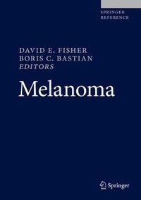 Cover image for Melanoma