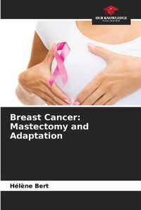 Cover image for Breast Cancer