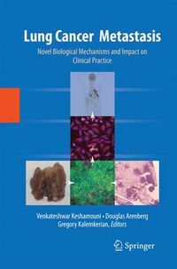 Cover image for Lung Cancer Metastasis: Novel Biological Mechanisms and Impact on Clinical Practice