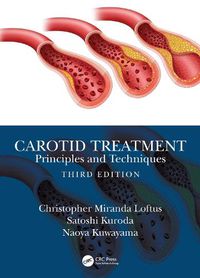 Cover image for Carotid Treatment: Principles and Techniques