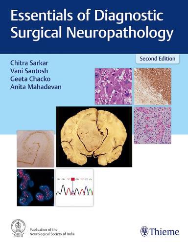 Cover image for Essentials of Diagnostic Surgical Neuropathology