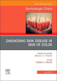 Cover image for Diagnosing Skin Disease in Skin of Color, An Issue of Dermatologic Clinics: Volume 41-3